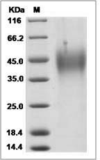 Human TMEM156 Protein (His Tag)