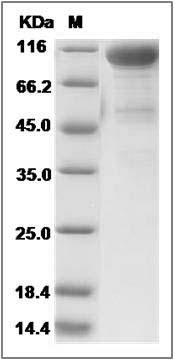 Rat DDR2 Kinase / CD167b Protein (Fc Tag) SDS-PAGE