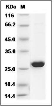 Human AK4 / Adenylate Kinase 4 / AK3L1 Protein SDS-PAGE
