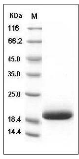 Human IL33 / Interleukin-33 / NF-HEV Protein SDS-PAGE