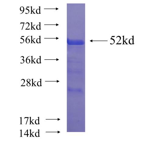 Recombinant human VWA5A SDS-PAGE