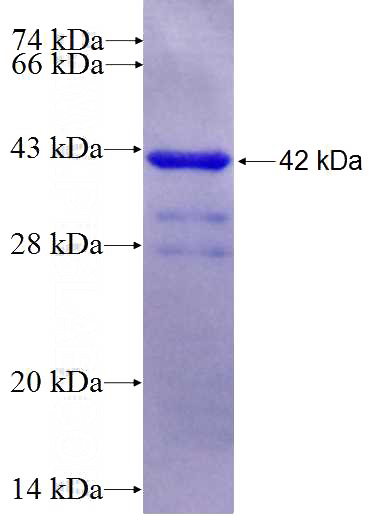 Recombinant Human WNT2 SDS-PAGE