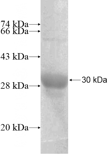 Recombinant Human GPR97 SDS-PAGE