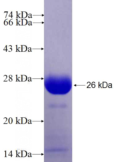 Recombinant Human TPT1 SDS-PAGE