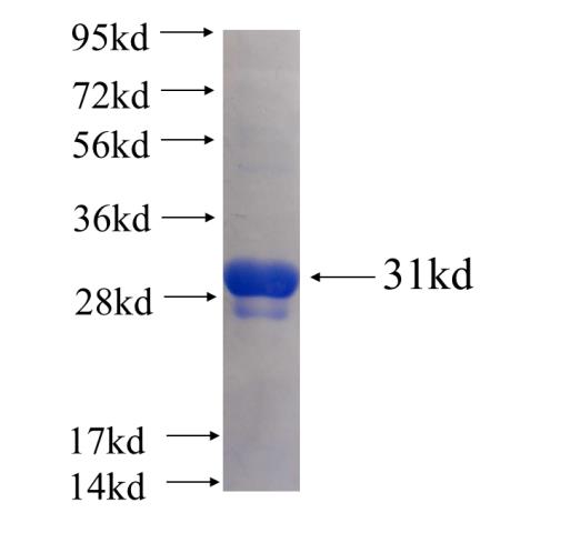 Recombinant human CEP70 SDS-PAGE