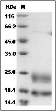 Rat CD302 / CLEC13A Protein (His Tag) SDS-PAGE