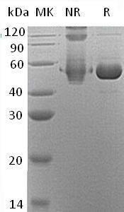 Human SERPINB12 (His tag) recombinant protein