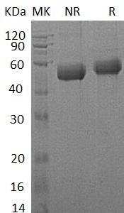 Human IL18RAP/IL1R7 (His tag) recombinant protein