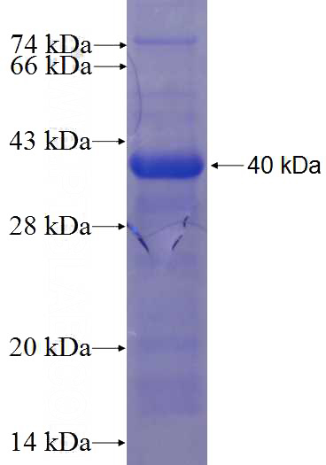 Recombinant Human WDR59 SDS-PAGE
