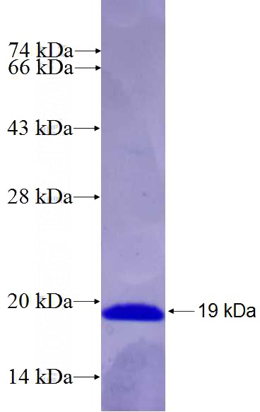 Recombinant Human SCN8A SDS-PAGE