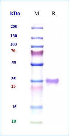 SARS-CoV-2 Spike RBD Protein (His Tag)
