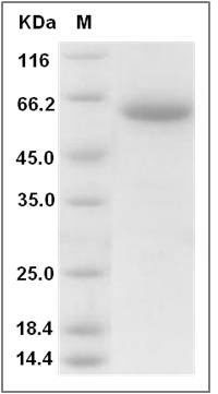 Human CLEC10A / MGL1 / CD301 Protein (Fc Tag) SDS-PAGE