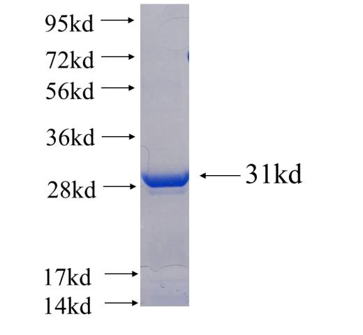 Recombinant human MMACHC SDS-PAGE