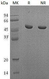 Human NADK (His tag) recombinant protein
