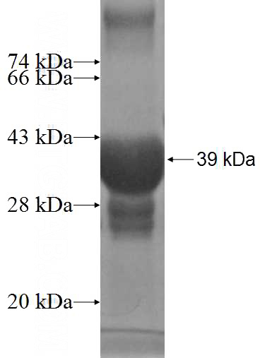 Recombinant Human SMCP SDS-PAGE
