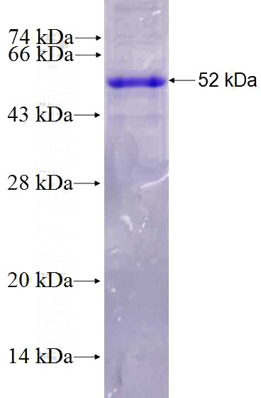 Recombinant Mouse Pecam1 SDS-PAGE