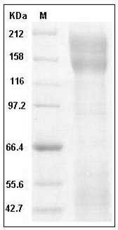Human CD171 / N-CAML1 / L1CAM Protein (His Tag) SDS-PAGE