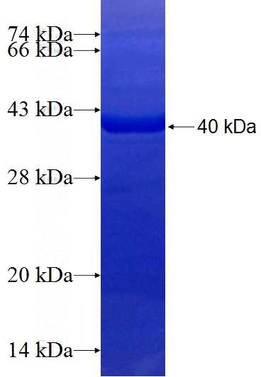 Recombinant Human EEPD1 SDS-PAGE