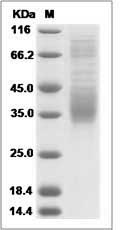 Canine PD1 / PDCD1 / CD279 Protein (His Tag) SDS-PAGE