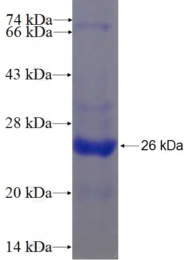 Recombinant Human ZDHHC1 SDS-PAGE