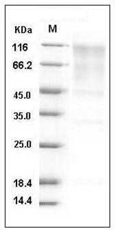 Human KIM-1 / TIM1 / HAVCR1 Protein SDS-PAGE