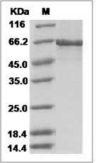 Human ACTR3 Protein (His & GST Tag) SDS-PAGE