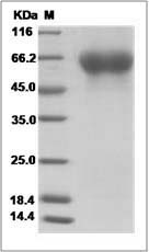 Influenza B (B/Hong Kong/05/1972) Hemagglutinin / HA1 Protein (His Tag)