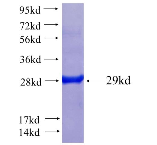 Recombinant human PPP4R2 SDS-PAGE