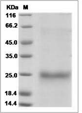 Human GITR / TNFRSF18 Protein (His Tag)