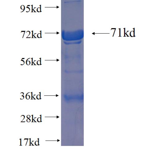 Recombinant human ARC SDS-PAGE