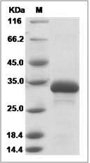 Plasmodium falciparum (strain 3D7) HPRT Protein (His Tag)