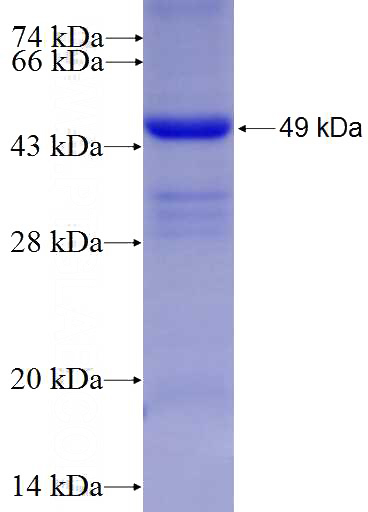Recombinant Human EPHX1 SDS-PAGE