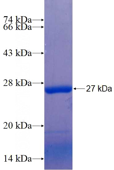 Recombinant Human NUDT16 SDS-PAGE