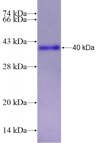 Recombinant Human CHST4 SDS-PAGE