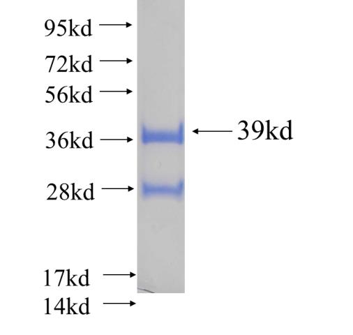 Recombinant human C11orf67 SDS-PAGE