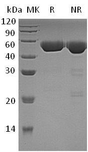 Human EPCAM/GA733-2/M1S2/M4S1 (His tag) recombinant protein