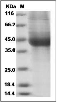 Human IL17BR / IL17RB / IL-17 Receptor B Protein (His Tag) SDS-PAGE