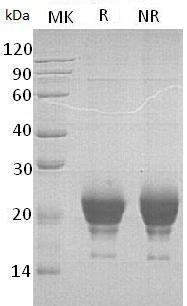 Human RNASE6/RNS6 (His tag) recombinant protein