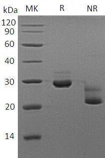 Mouse Vsig8 (His tag) recombinant protein