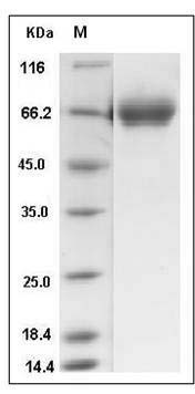 Human TRP1 / TYRP1 Protein (His Tag) SDS-PAGE