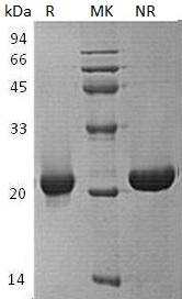 Human SENP7/KIAA1707/SSP2/SUSP2 (His tag) recombinant protein