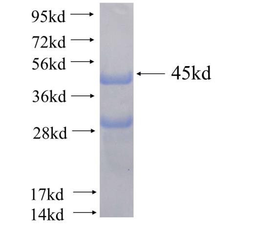 Recombinant human CCDC104(Full length) SDS-PAGE