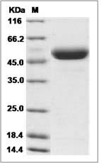 Rat CD4 Protein (His Tag) SDS-PAGE