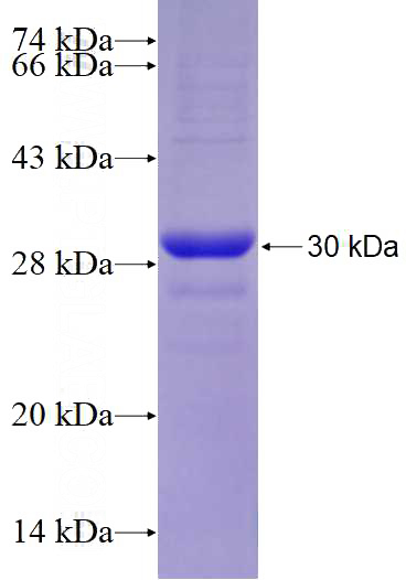 Recombinant Human PMCA2 SDS-PAGE