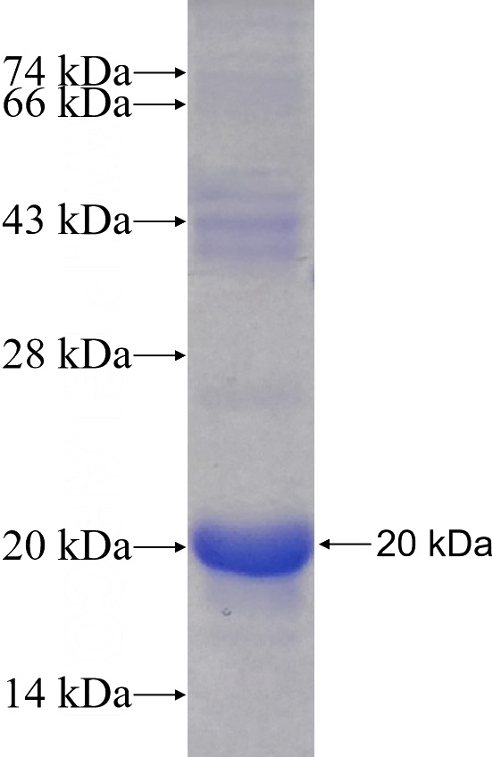 Recombinant Human TICAM1 SDS-PAGE