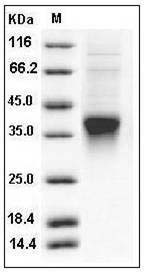 Human Clusterin / Apolipoprotein J / Apo-J / CLU Protein (His Tag) SDS-PAGE