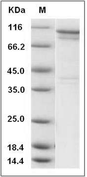 Human PS6K / RPS6KB1 Protein (GST Tag) SDS-PAGE