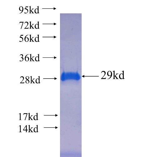 Recombinant human UNC119B(Full length) SDS-PAGE