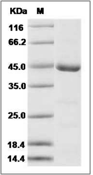 Human TLK2 / PKU-ALPHA Protein (aa 397-772) SDS-PAGE