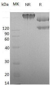 Mouse Sema4d/Semacl2/Semaj (Fc tag) recombinant protein